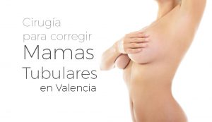 Cirugía para corregir las mamas tuberosas en Valencia