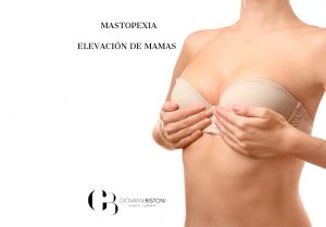mastopexia elevación de mamas en Valencia