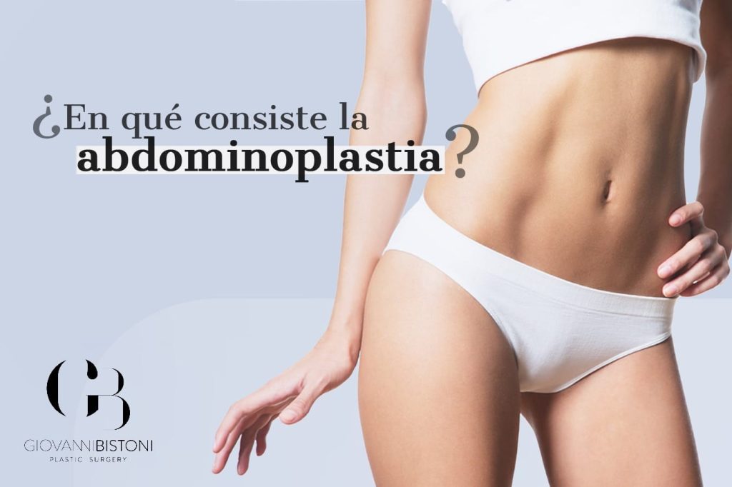 ¿En qué consiste la abdominoplastia?
