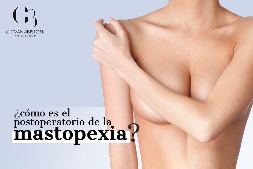 postoperatorio de mastopexia cómo es