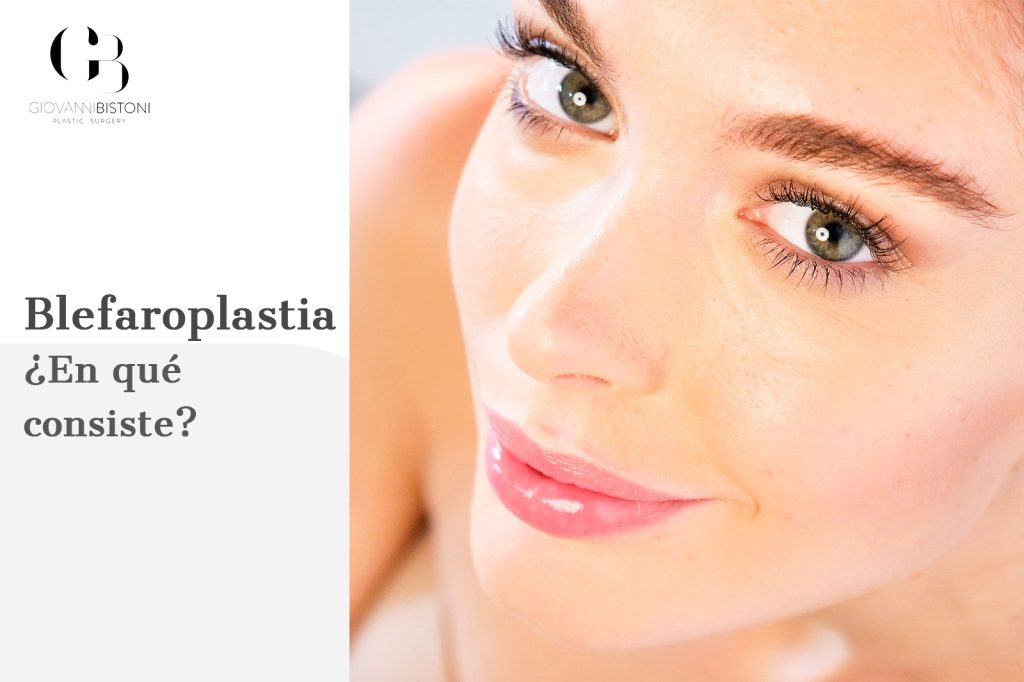 Blefaroplastia ¿en qué consiste?