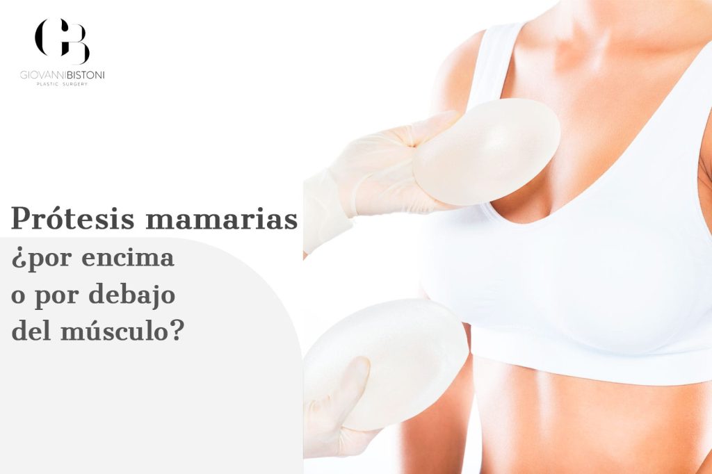 prótesis mamarias ¿por encima o por debajo del músculo?