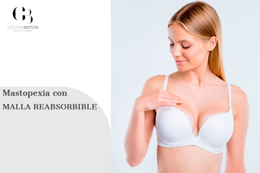 mastopexia con malla reabsorbible