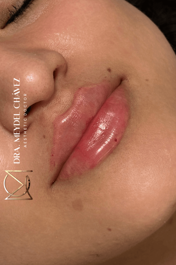 meydel-chavez-medicina-estetica-10.png