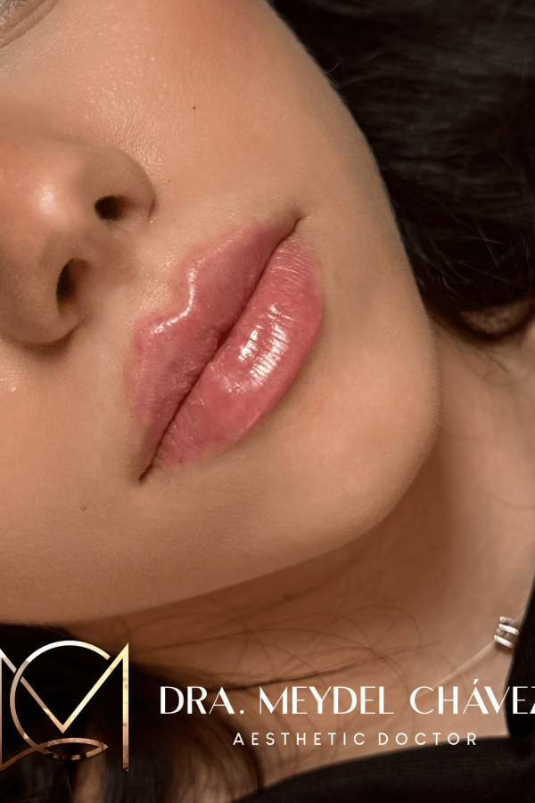 meydel-chavez-medicina-estetica-2.png