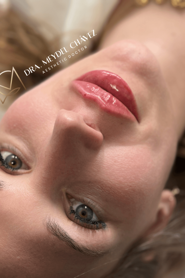 meydel-chavez-medicina-estetica-6.png
