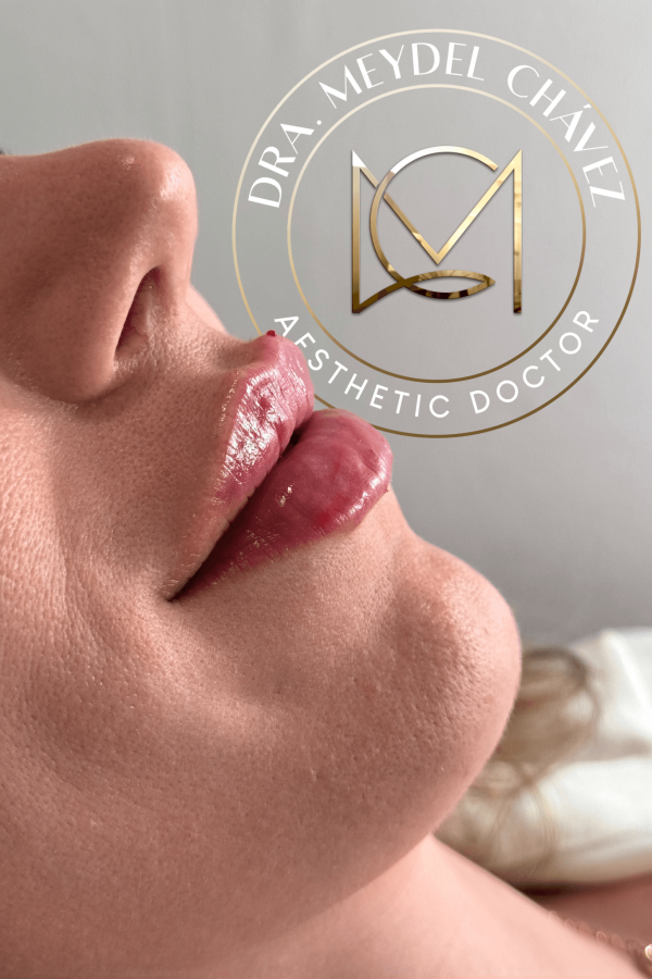 meydel-chavez-medicina-estetica-8.png