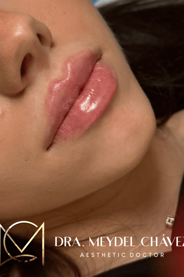 meydel-chavez-medicina-estetica-9.png